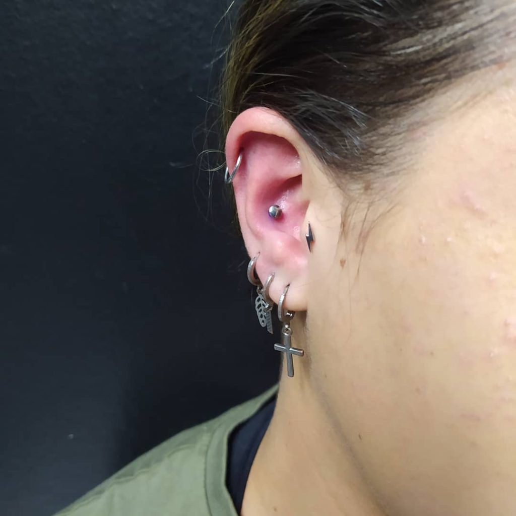 Remedio Caseiro Para Queloide De Piercing Na Orelha